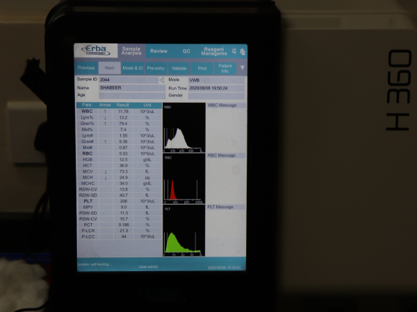 Urine Analyzer